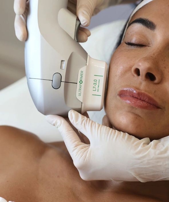 tratamiento HIFU facial con Ultraformer III para tensar la piel y reducir la flacidez